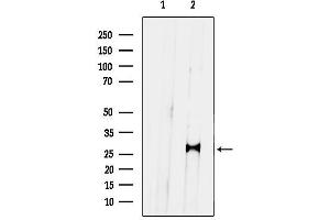 Western blot analysis of lysates from NIH-3 cells, using PRRX1 Antibody.
