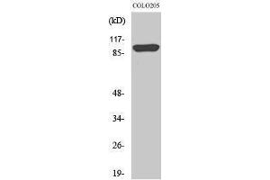 Western Blotting (WB) image for anti-Proteasome (Prosome, Macropain) 26S Subunit, Non-ATPase, 2 (PSMD2) (N-Term) antibody (ABIN3177038) (PSMD2 anticorps  (N-Term))