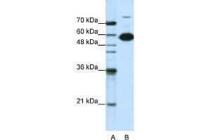 WB Suggested Anti-NONO Antibody Titration:  1. (NONO anticorps  (C-Term))
