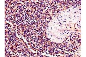 Immunohistochemistry of paraffin-embedded human spleen tissue using ABIN7174011 at dilution of 1:100