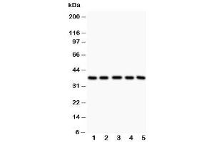 Western blot testing of LOX-1 antibody and Lane 1:  rat liver (OLR1 anticorps  (Middle Region))
