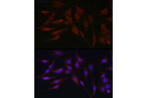 Immunofluorescence analysis of C6 cells using G Rabbit pAb (ABIN6129931, ABIN6137010, ABIN6137011 and ABIN6217659) at dilution of 1:100 (40x lens).
