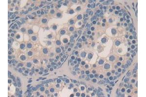 DAB staining on IHC-P; Samples: Mouse Testis Tissue