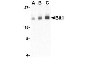 Western blot analysis of Bit1 in Daudi cell lysate with AP30153PU-N Bit1 antibody at (A) 1, (B) 2, and (C) 4 μg/ml. (PTRH2 anticorps  (Middle Region))