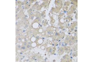 Immunohistochemistry of paraffin-embedded human liver injury using CHMP1B antibody (ABIN5974811) at dilution of 1/100 (40x lens). (CHMP1B anticorps)