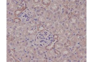 Immunohistochemical analysis of paraffin-embedded mouse kidney, using IKK alpha Antibody.
