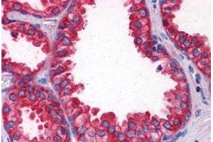 Human Prostate: Formalin-Fixed, Paraffin-Embedded (FFPE)