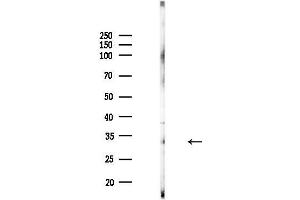 Western blot analysis of lysates from MDA-MB-231 cells(heat-shock,45 min treatment), using TTC19 Antibody at 1/1000 dilution.