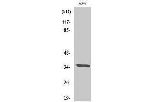 Western Blotting (WB) image for anti-Peroxisomal Biogenesis Factor 2 (PEX2) (N-Term) antibody (ABIN3176842) (PEX2 anticorps  (N-Term))