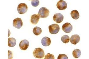 Immunocytochemistry of IL-21 in K562 cells with AP30413PU-N IL-21 antibody at 2 μg/ml.