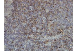 anti-SH2 Domain Containing 3C (SH2D3C) (AA 1-110) antibody