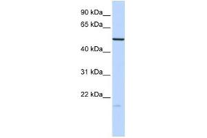 Human Brain; WB Suggested Anti-ZNF773 Antibody Titration: 0. (ZNF773 anticorps  (N-Term))