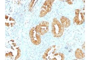 IHC testing of FFPE human rectum tissue with Villin antibody (clone VIL1/1314). (Villin 1 anticorps  (AA 179-311))