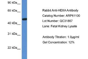 Western Blotting (WB) image for anti-Hexosaminidase A (HEXA) (C-Term) antibody (ABIN786333) (Hexosaminidase A anticorps  (C-Term))