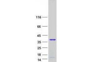 Validation with Western Blot