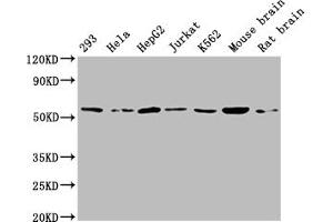 Western Blot Positive WB detected in: 293 whole cell lysate, Hela whole cell lysate, HepG2 whole cell lysate, Jurkat whole cell lysate, K562 whole cell lysate, Mouse brain tissue, Rat brain tissue All lanes: ATP5A1 antibody at 1:2000 Secondary Goat polyclonal to rabbit IgG at 1/50000 dilution Predicted band size: 60, 55, 58 kDa Observed band size: 60 kDa (ATP5F1A (AA 59-257) anticorps)