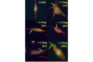 Time course study of mouse leukaemic monocyte macrophage cells treated with U18666A, a drug that causes cholesterol and lipid storage in cells, thereby blocking fusion between late endosomes and lysosomes.