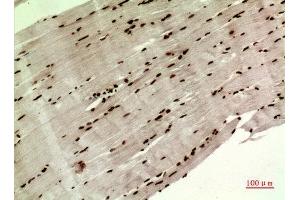 Immunohistochemistry (IHC) analysis of paraffin-embedded Human Muscle, antibody was diluted at 1:100.