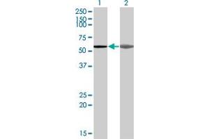 Western Blot analysis of AKAP5 expression in transfected 293T cell line by AKAP5 monoclonal antibody (M04), clone 1A9.