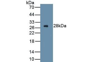 Detection of Recombinant ICAM2, Human using Polyclonal Antibody to Intercellular Adhesion Molecule 2 (ICAM2)