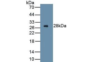 Detection of Recombinant ICAM2, Human using Polyclonal Antibody to Intercellular Adhesion Molecule 2 (ICAM2) (ICAM2 anticorps  (AA 34-241))