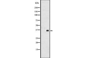 Western blot analysis of OR2A12 expression in CEM cell line lysates ,The lane on the left is treated with the antigen-specific peptide.