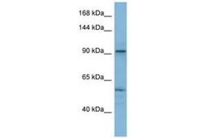 Image no. 1 for anti-ATPase, Ca++ Transporting, Cardiac Muscle, Fast Twitch 1 (ATP2A1) (N-Term) antibody (ABIN6741780)