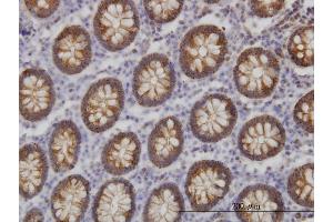 Immunoperoxidase of monoclonal antibody to BAIAP2L1 on formalin-fixed paraffin-embedded human colon. (BAIAP2L1 anticorps  (AA 398-511))