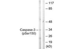 Western blot analysis of extracts from Jurkat cells treated with Etoposide 25uM 60', using Caspase 3 (Phospho-Ser150) Antibody. (Caspase 3 anticorps  (pSer150))