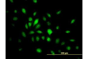 Image no. 4 for anti-High Mobility Group 20B (HMG20B) (AA 1-110) antibody (ABIN599130) (HMG20B anticorps  (AA 1-110))