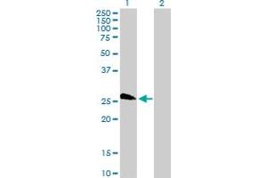 Western Blot analysis of LOC391746 expression in transfected 293T cell line by LOC391746 MaxPab polyclonal antibody. (TAF11L4 anticorps  (AA 1-198))