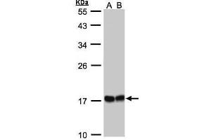 WB Image Sample(30 ug whole cell lysate) A:293T whole cell lysate B:A431, 12% SDS PAGE antibody diluted at 1:1000 (HSPB8 anticorps  (C-Term))