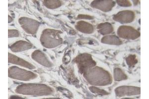 Detection of cTnI in Porcine Tongue Tissue using Polyclonal Antibody to Cardiac Troponin I (cTnI)