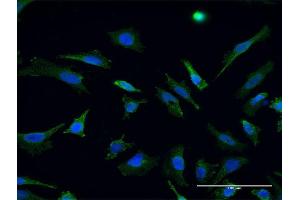 Immunofluorescence of monoclonal antibody to RHOT1 on HeLa cell.