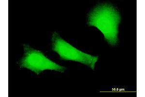 Immunofluorescence of monoclonal antibody to FANCC on HeLa cell.