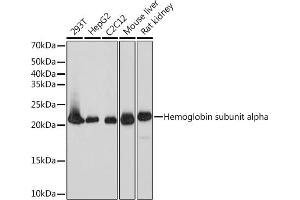 Western blot analysis of extracts of various cell lines, using DHFR Rabbit mAb (ABIN7266764) at 1:1000 dilution. (Dihydrofolate Reductase anticorps)