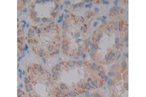 IHC-P analysis of Human Tissue, with DAB staining. (PDCD5 anticorps  (AA 2-125))