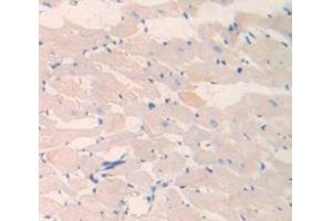 Used in DAB staining on fromalin fixed paraffin- embedded Kidney tissue (LAMC2 anticorps  (AA 1003-1192))