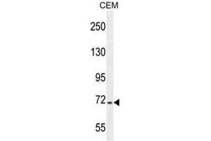 STIM1 Antibody (C-term) western blot analysis in CEM cell line lysates (35µg/lane). (STIM1 anticorps  (C-Term))