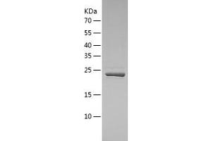 Western Blotting (WB) image for Ubiquitin Specific Peptidase 8 (USP8) (AA 886-1096) protein (His tag) (ABIN7125599) (USP8 Protein (AA 886-1096) (His tag))