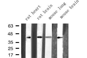 Western blot analysis of ARFIP1 expression in various lysates (ARFIP1 anticorps  (Internal Region))