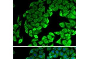 Immunofluorescence analysis of MCF-7 cells using RPL14 Polyclonal Antibody (RPL14 anticorps)
