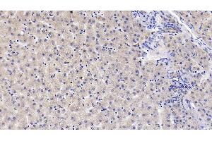 Detection of DBP in Human Liver Tissue using Monoclonal Antibody to Vitamin D Binding Protein (DBP)