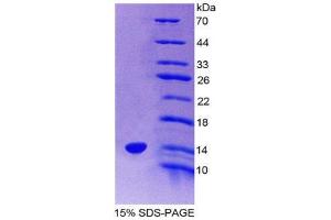 SDS-PAGE (SDS) image for Pre-B Lymphocyte 1 (VPREB1) (AA 43-128) protein (His tag) (ABIN2126394)