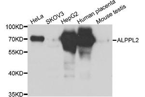 Western blot analysis of extracts of various cell lines, using ALPPL2 antibody (ABIN5975268) at 1/1000 dilution. (ALPPL2 anticorps)