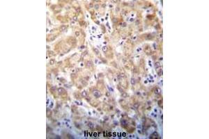 Immunohistochemistry in Formalin-fixed, Paraffin embedded human liver tissue stained with Syntaxin 2 / STX2 Antibody (Center) followed by peroxidase conjugation of the secondary antibody and DAB staining. (STX2 anticorps  (Middle Region))