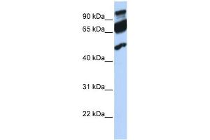 WB Suggested Anti-ERAL1 Antibody Titration:  0. (ERAL1 anticorps  (Middle Region))