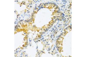 Immunohistochemistry of paraffin-embedded mouse lung using IL20 antibody (ABIN6128133, ABIN6142353, ABIN6142354 and ABIN6222322) at dilution of 1:100 (40x lens). (IL-20 anticorps  (AA 25-176))