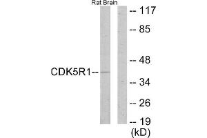 Western blot analysis of extracts from rat brain cells, using CDK5R1 antibody. (CDK5R1 anticorps  (N-Term))