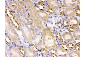 IHC testing of FFPE mouse kidney with ACTN4 antibody at 1ug/ml. (alpha Actinin 4 anticorps)